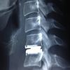 Mitchelton Physiotherapy Sport & Rehabilitation Centre