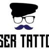 Laser Tattoff