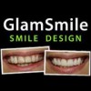 GlamSmile