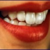 Active Denture Clinic