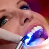 GlamSmile