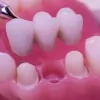 MS Dental